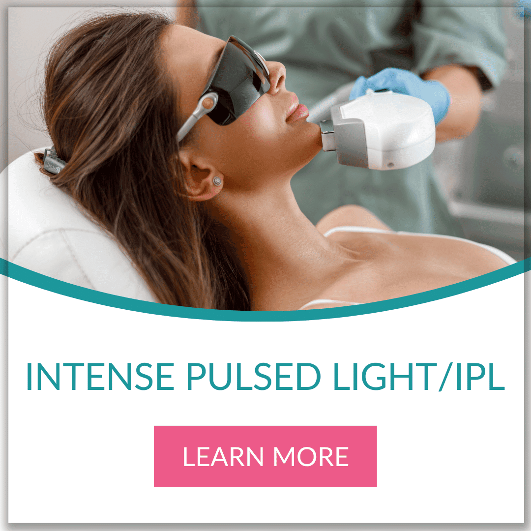 intense pulsed light therapy IPL