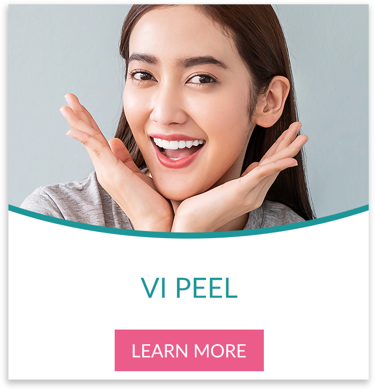 VI Chemical Peel