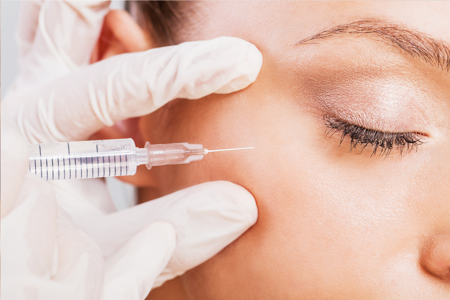 woman getting botox injections around eye area Cosmetic Botox injections near Cape Coral and Fort Myers for wrinkle reduction and facial rejuvenation