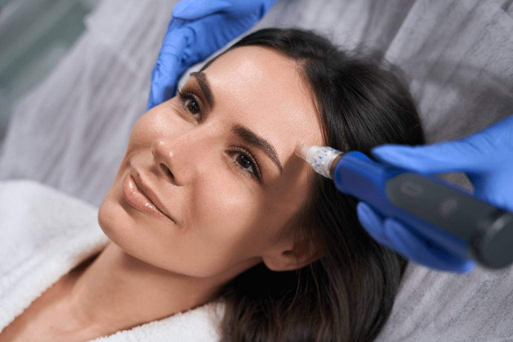 woman receiving a skin pen microneedling treatment