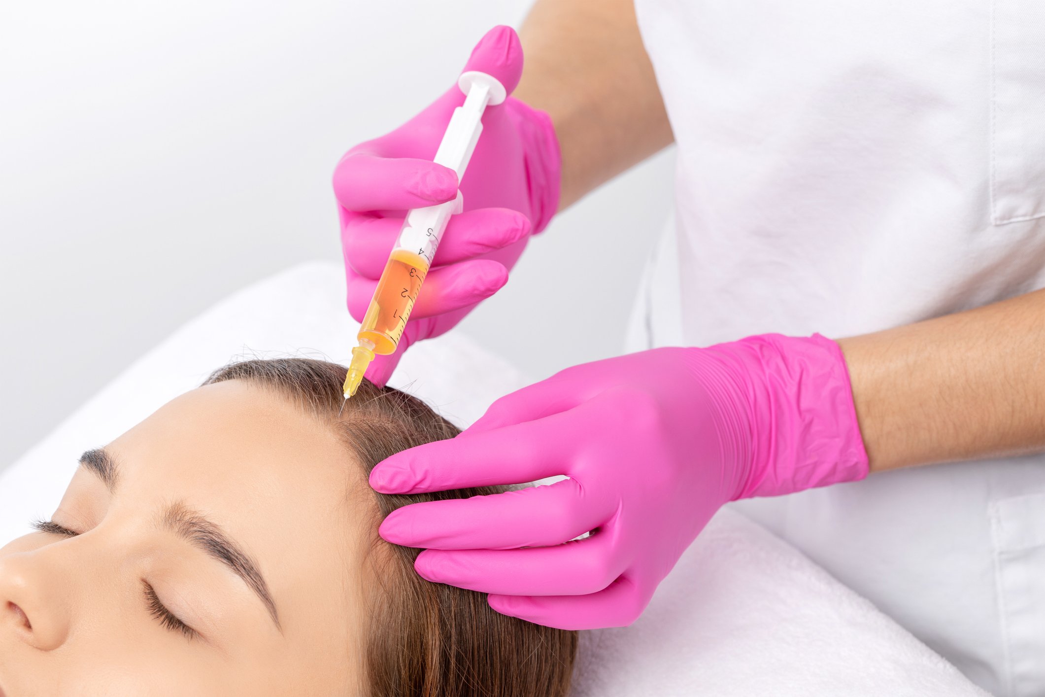 Cosmetologist does prp therapy against hair loss and anti-dandruff of a beautiful woman in a beauty salon. Aesthetic cosmetology concept, hair treatment.