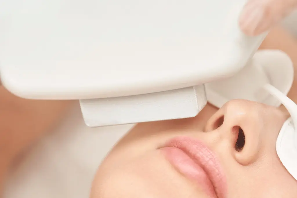 Close up of a woman's face receiving IPL Therapy