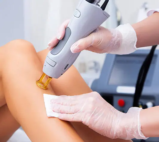 laser hair removal cost in fort myers area florida at skin spot laser club in cape coral Laser Hair Removal in Cape Coral & Fort Myers: Why Timing Matters for the Best Results